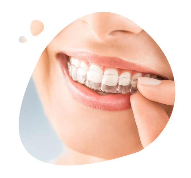 https://www.expertsdentalclinic.com/wp-content/uploads/2021/05/dis-duzeltme-tedavisi-640x597.png