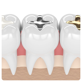 https://www.expertsdentalclinic.com/wp-content/uploads/2021/05/kompozit-dolgu2.jpg