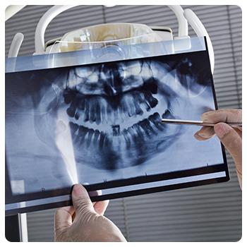 https://www.expertsdentalclinic.com/wp-content/uploads/2021/05/panorama-xray2.jpg